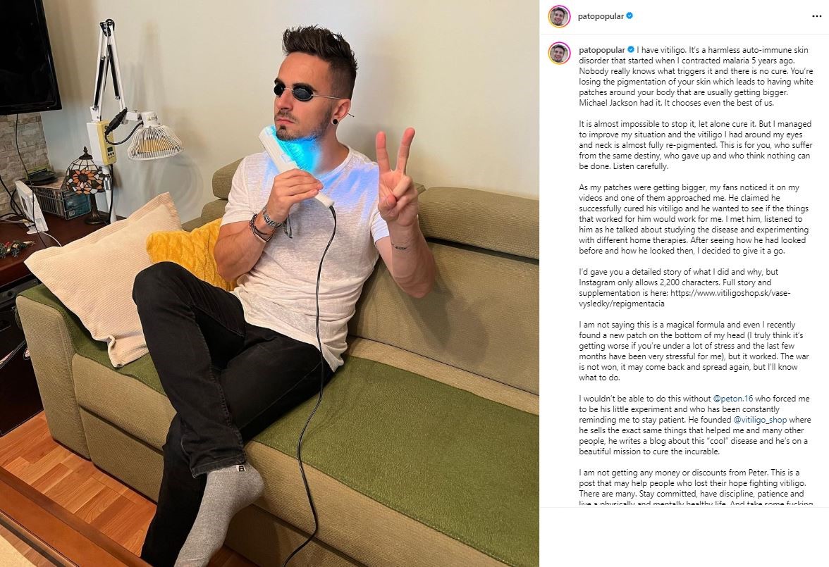 Pppeter vitiligo treatment IG